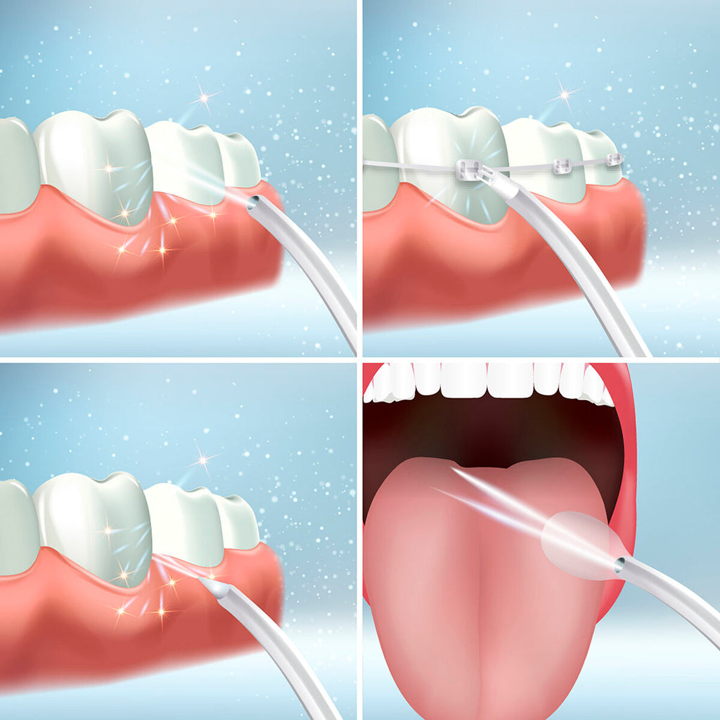 Denter InnovaGoods portable rechargeable oral irrigator